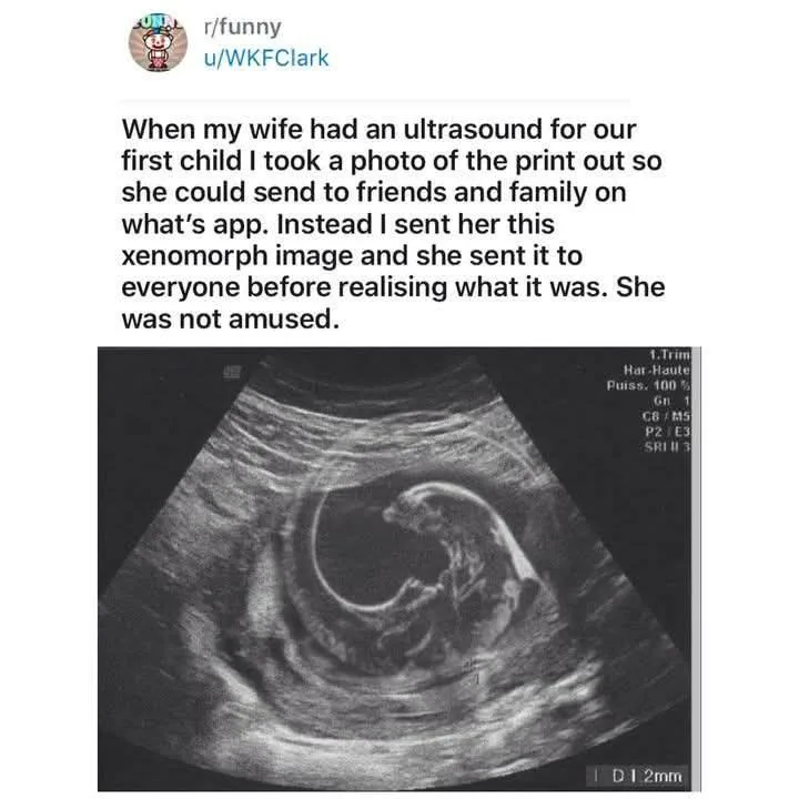 An ultrasound image of a fetus is overlaid with text describing a man's mistake: he sent his wife's ultrasound photo to…