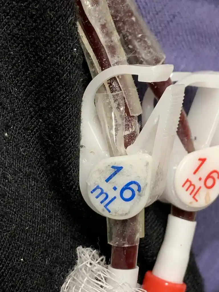 A close-up photo shows two medical tubing connectors, each marked with a small circular label indicating '1.6 mL'. One label…