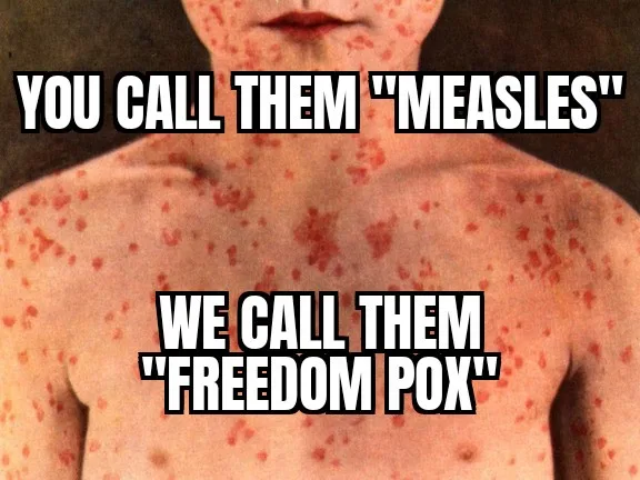 A person with visible red spots covering their face and torso, overlaid with bold white text reading 'YOU CALL THEM…