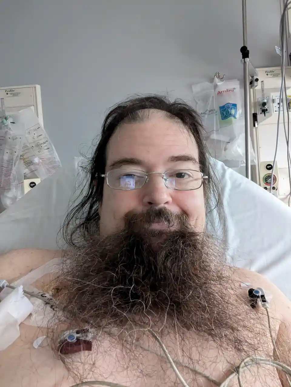 A man with a long, thick beard and glasses lies in a hospital bed surrounded by medical equipment, including IV bags and…