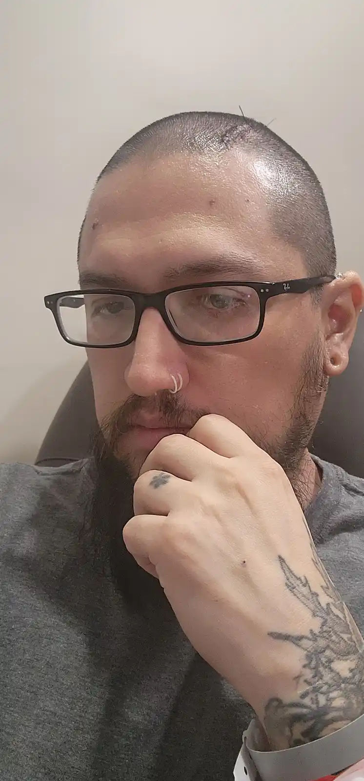 A man with a shaved head, black-rimmed glasses, and a beard looks thoughtfully at the camera with his hand on his chin. A…