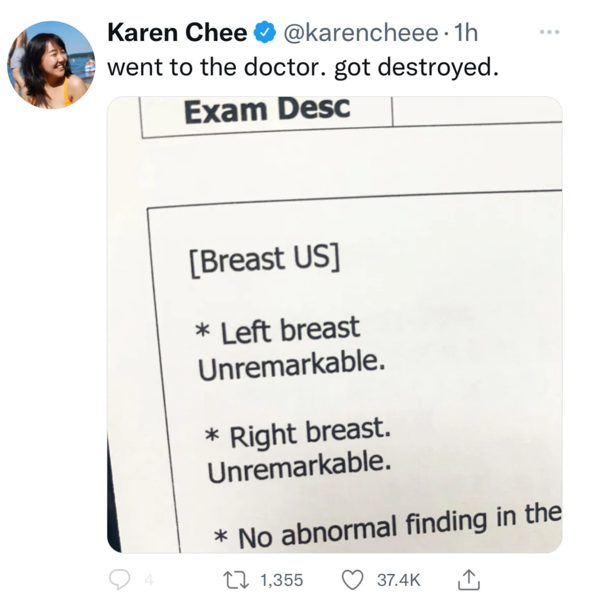 A close-up photo of a medical report under 'Exam Desc' shows a 'Breast US' with entries for 'Left breast Unremarkable' and…
