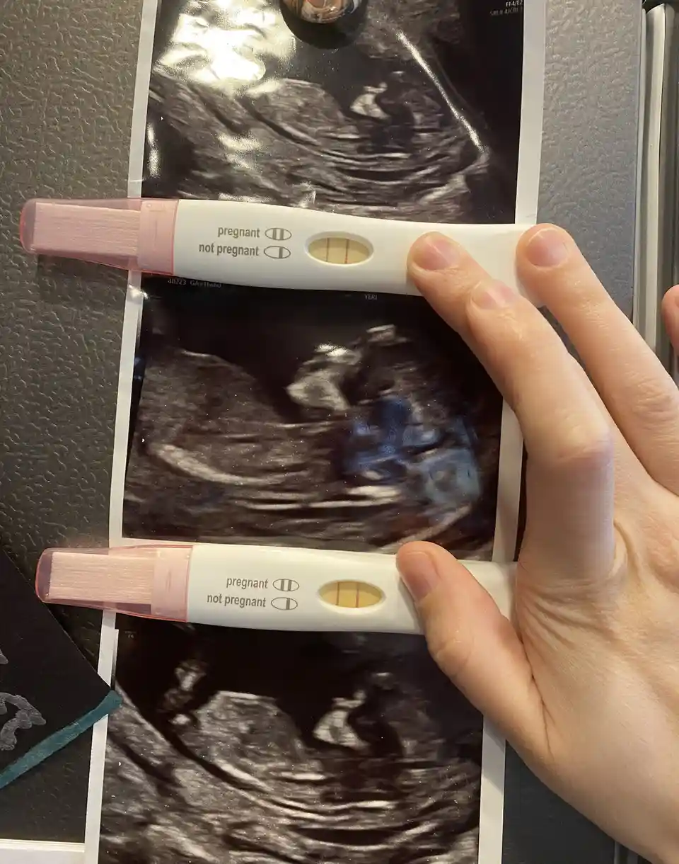 A hand holds two identical positive pregnancy tests, each showing two lines, positioned horizontally over three printed…