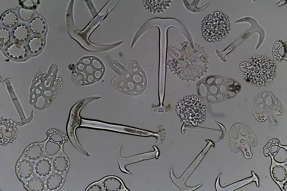 A microscopic image shows various fungal spores and structures, including several hook-shaped forms resembling hammers…