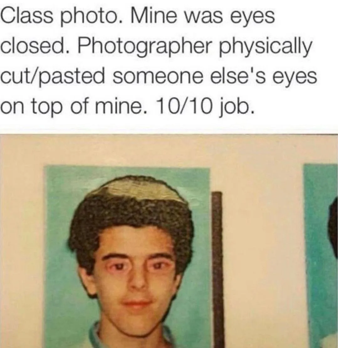 A vintage class photo shows a young man with mismatched eyes: one eye is his own, the other is a different person's eye…