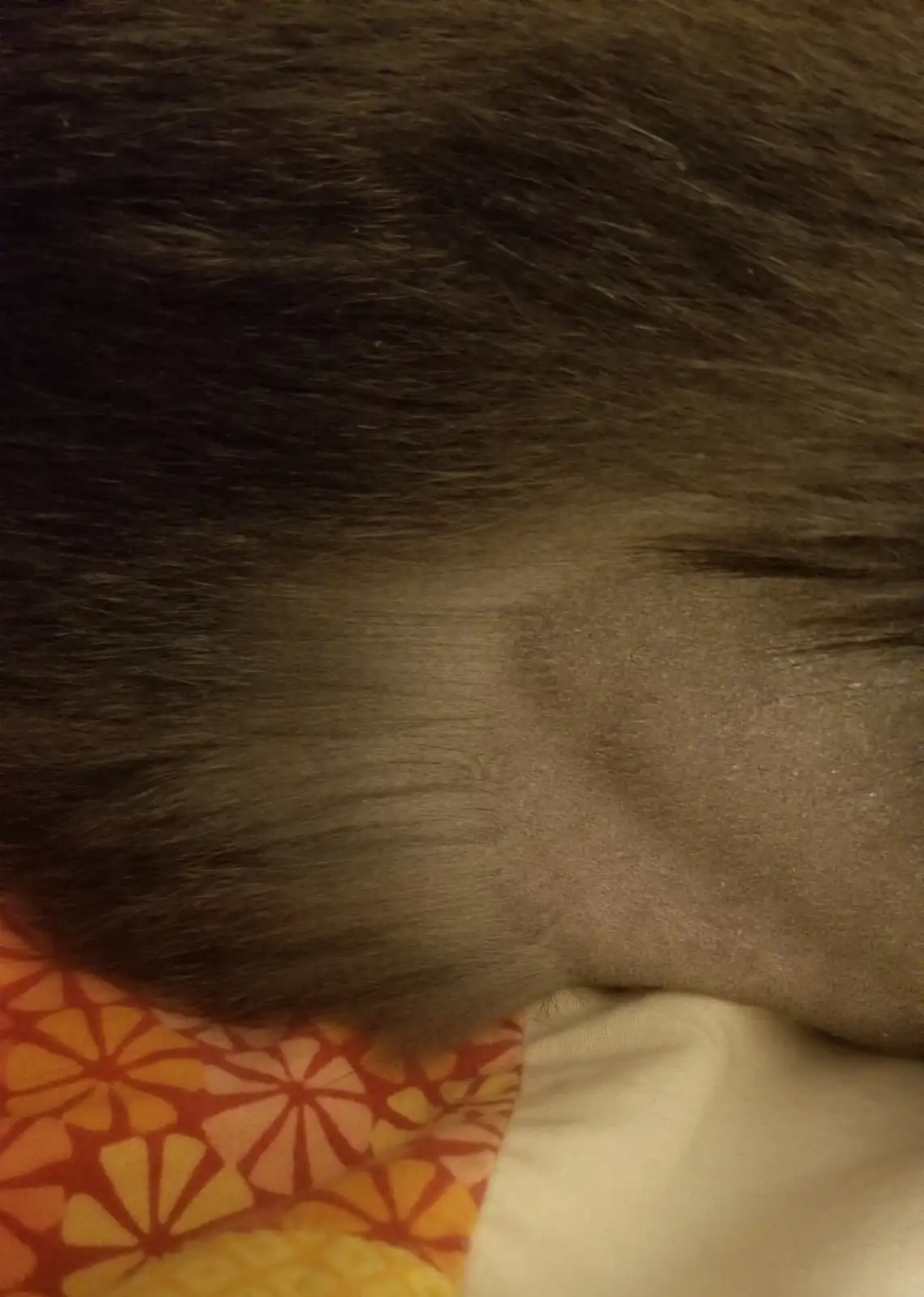 A close-up photo shows the back of a person's head with dark hair, but a noticeable bald patch is visible on the right side…